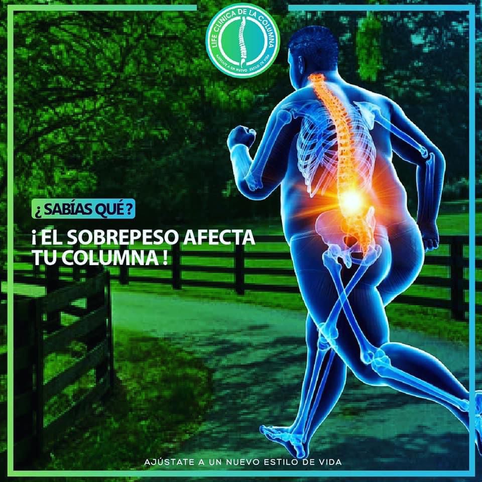 Sobrepeso y sus consecuencias sobre la columna vertebral