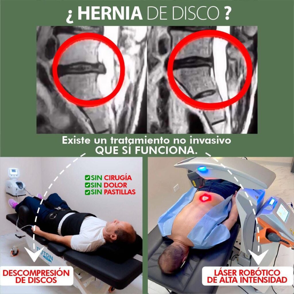 Láser robótico M8 de alta intensidad